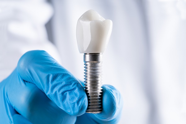 Reasons To Choose Dental Implants To Replace Missing Teeth