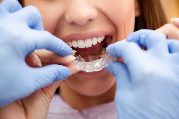 Tips For Finding An Invisalign Dentist Near Reading