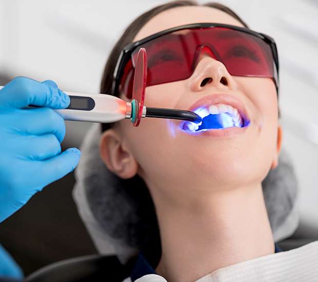 Reading Professional Teeth Whitening